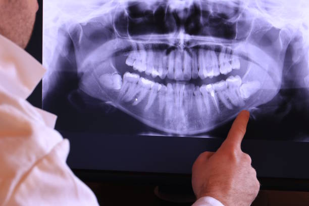 Best Emergency Tooth Extraction in Crete, IL