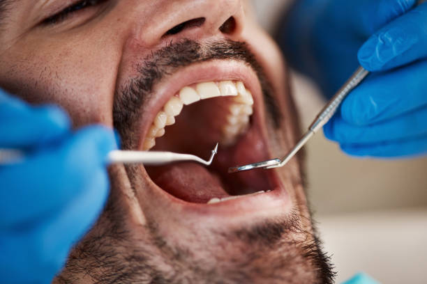 Best Emergency Treatment for Toothache in Crete, IL